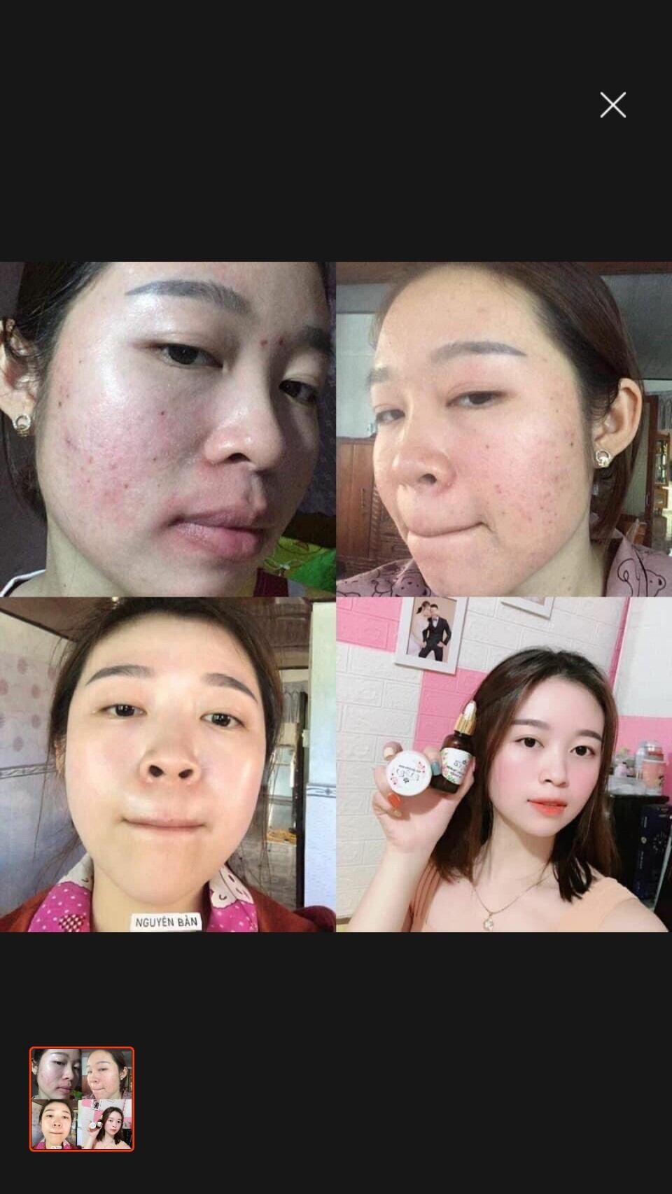 Kem face tổ yến B&B