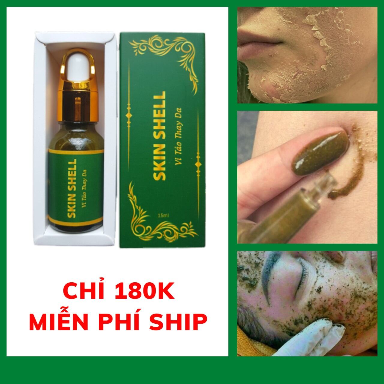 Combo 5 vi tảo bong da