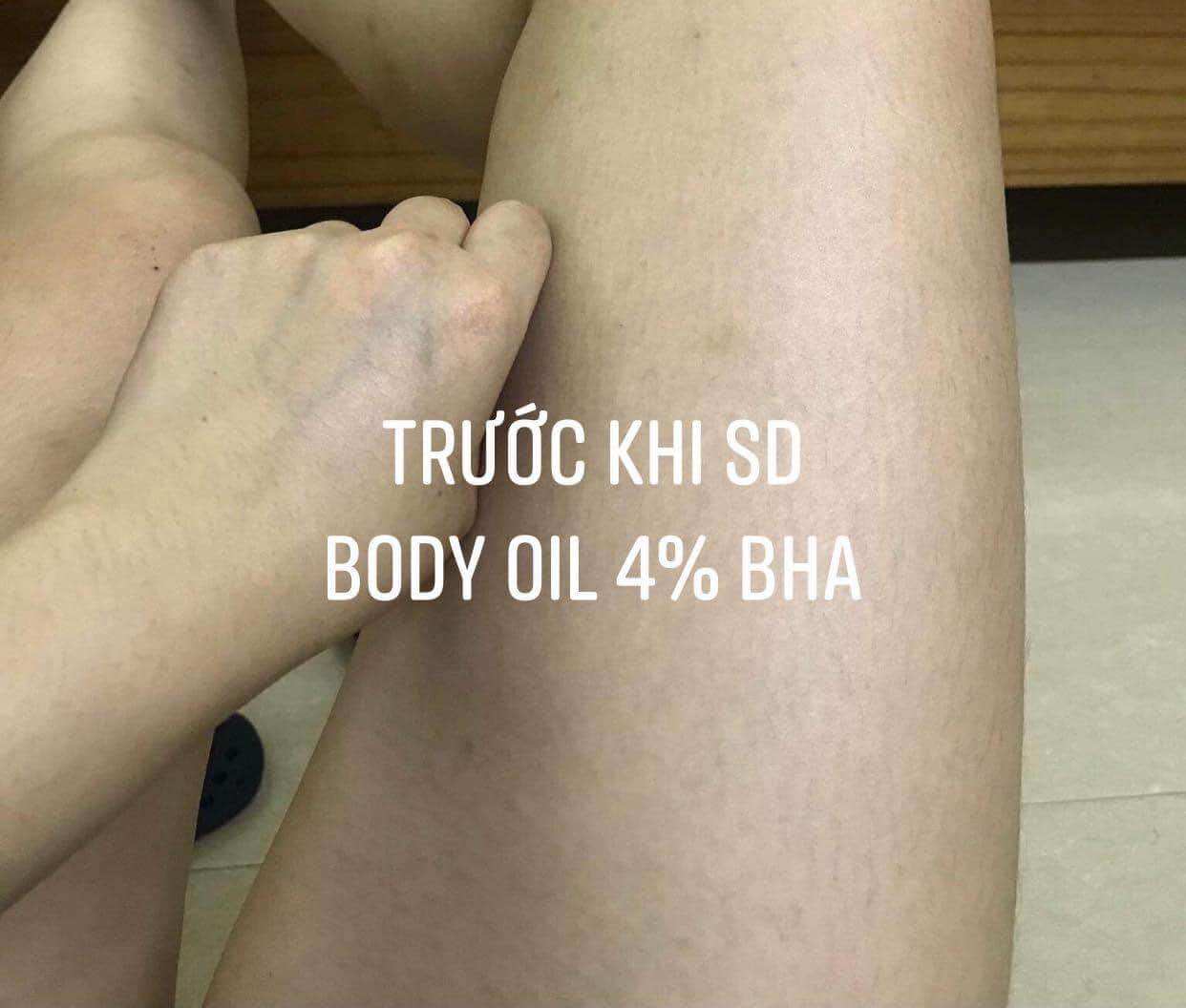 DẦU DƯỠNG DA BODY 4% BHA RUCOS