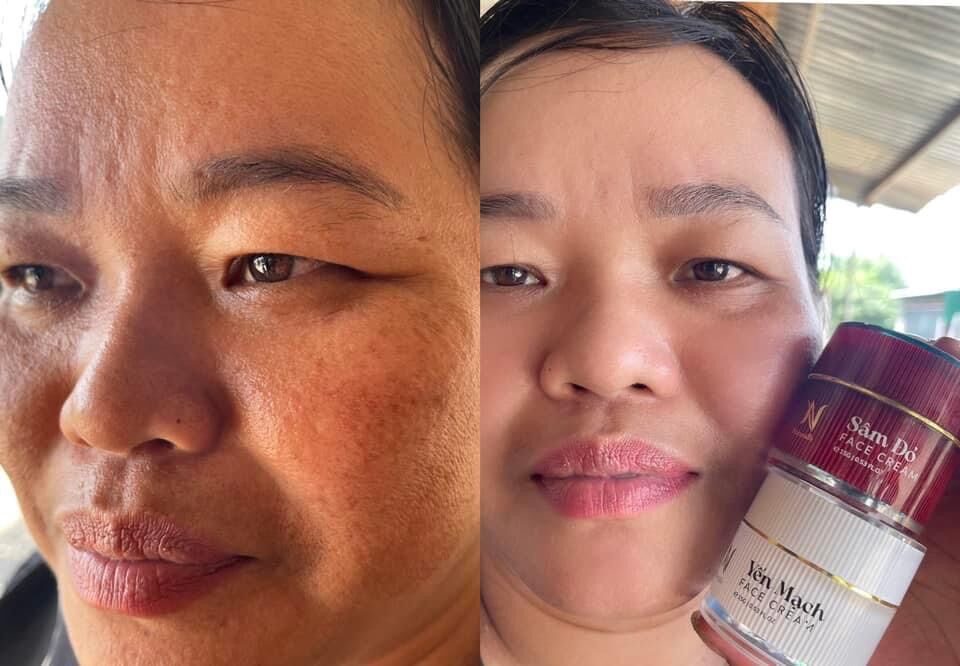 Combo face nám và yến mạch