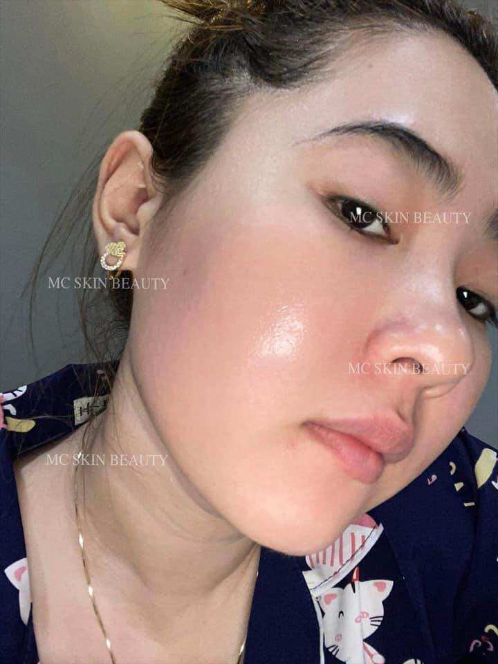 COMBO TÁI TẠO HỒNG SÂM MCSKIN