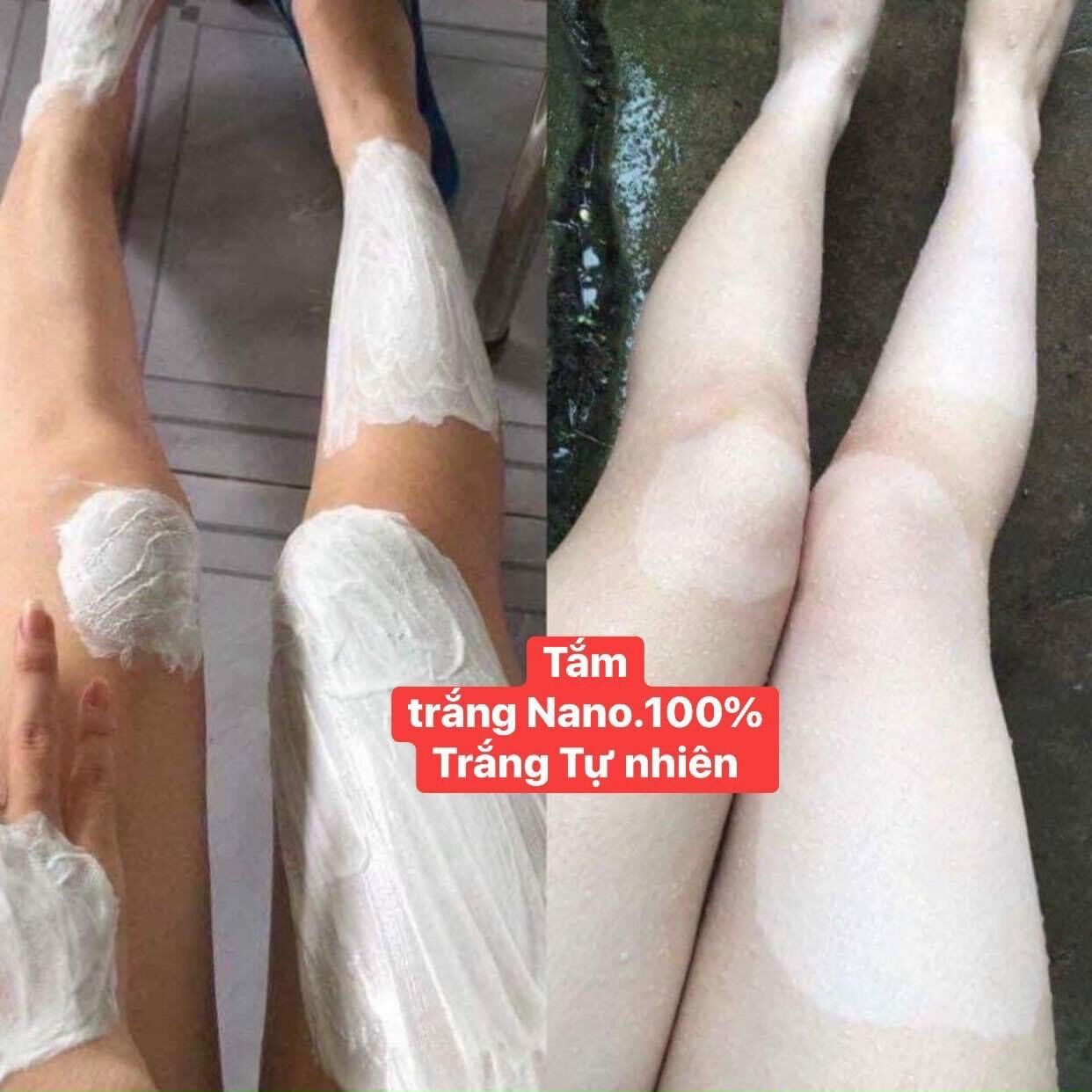 TRUYỀN TRẮNG NANO