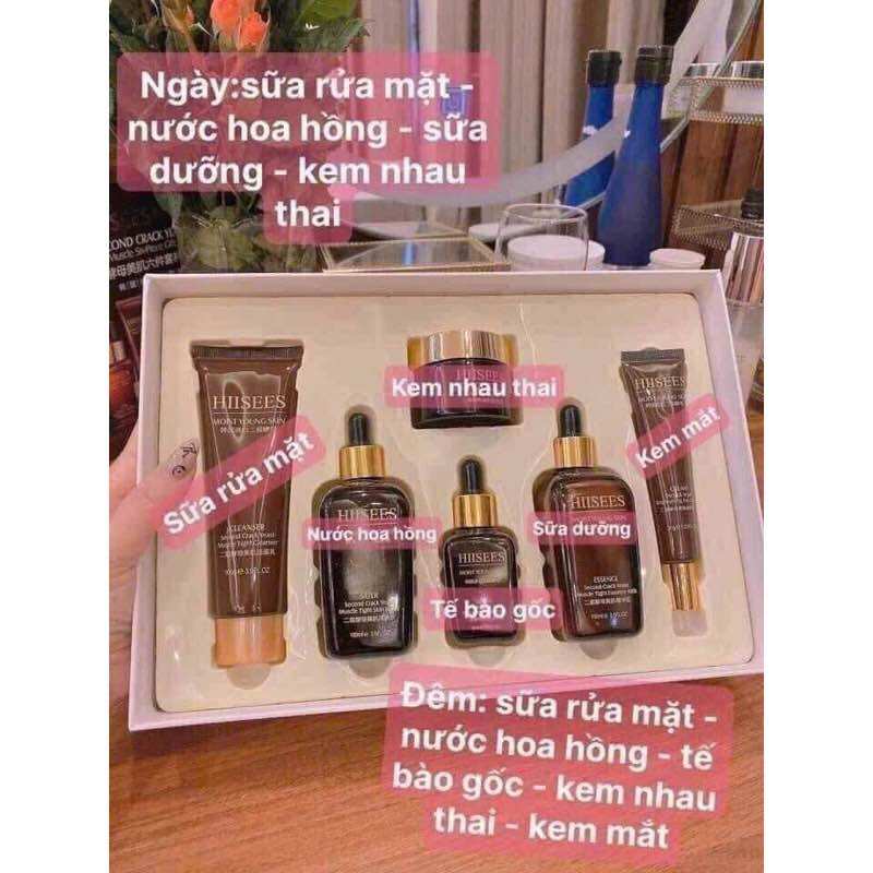 Kem dưỡng trắng da HISES, bộ 6 món
