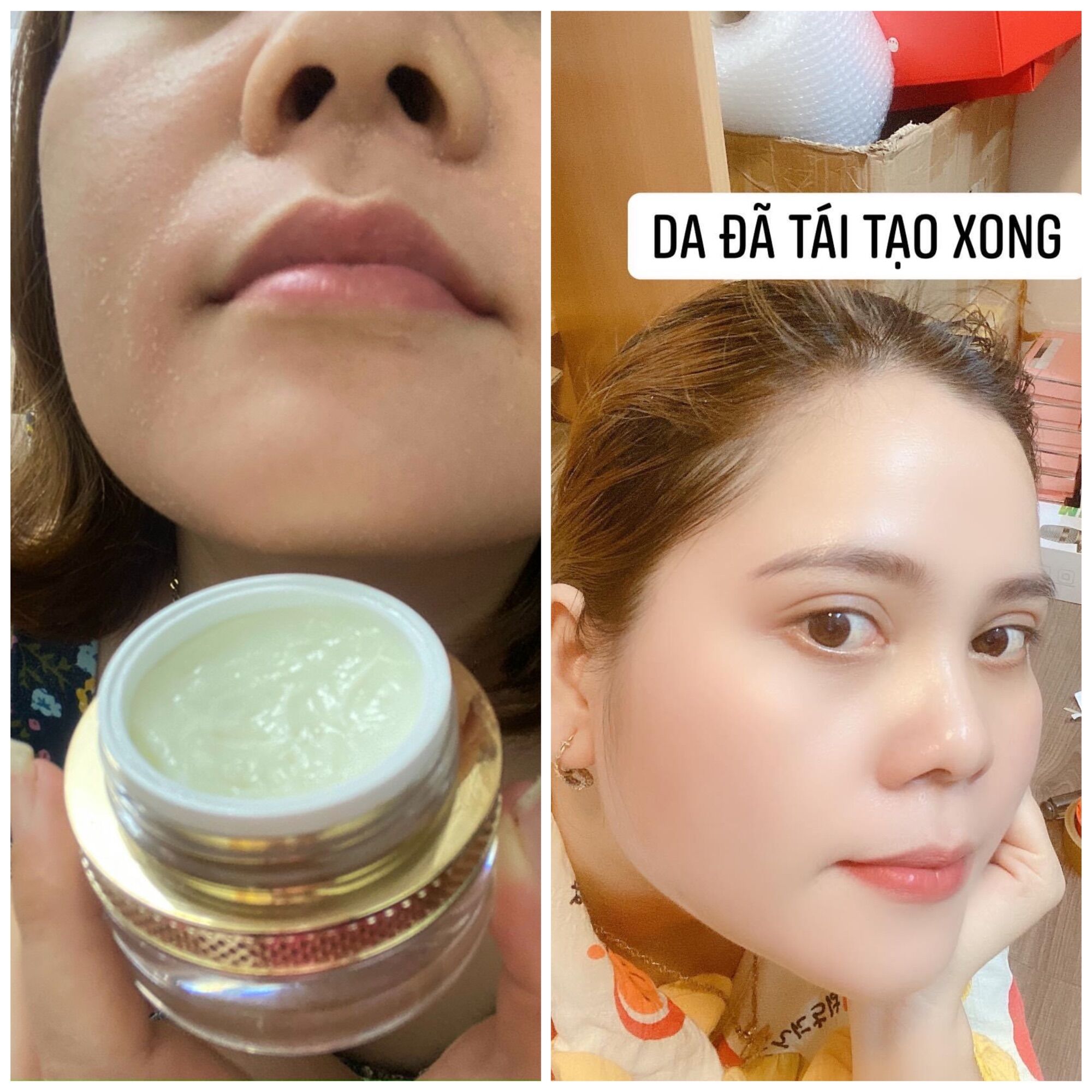 [HCM]KEM TÁI TẠO CHAMOMILESKILL