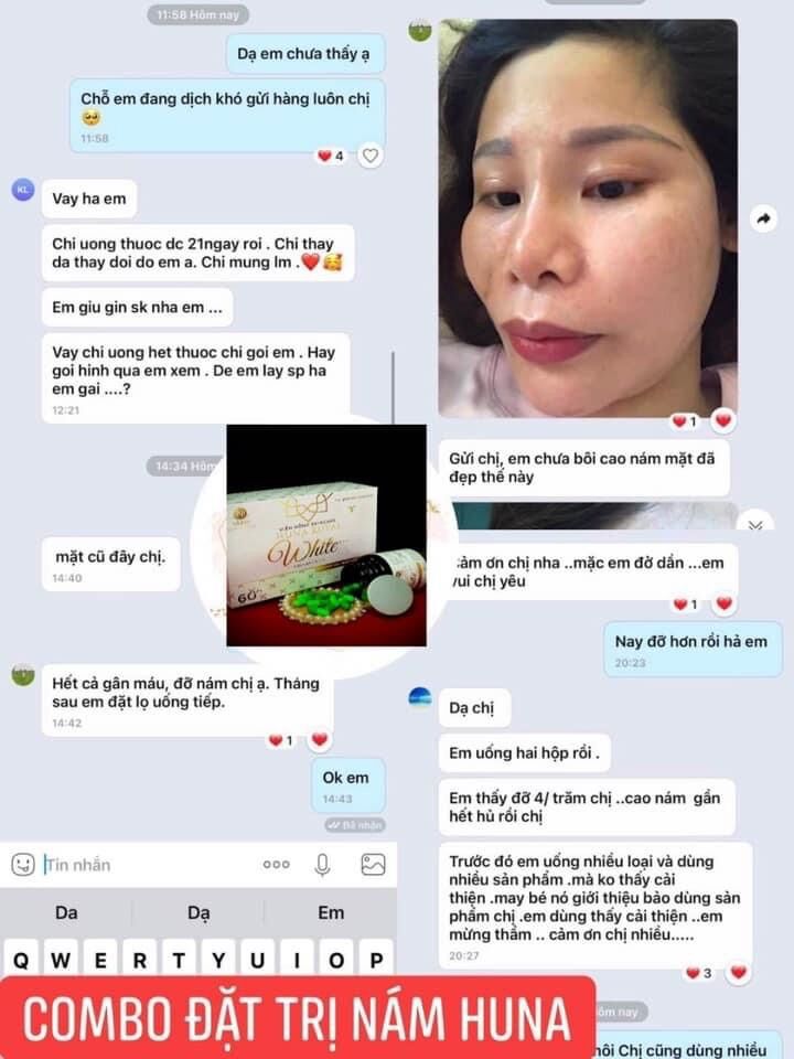 (Combo) Mờ NÁM CAO CẤP HUNA 1 L.TRÌNH HUNA