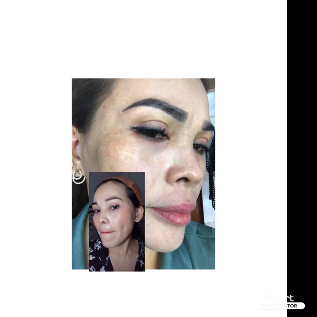 (Combo) Mờ NÁM CAO CẤP HUNA 1 L.TRÌNH HUNA
