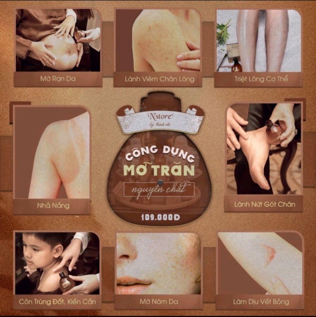Mỡ trăn nguyên chất N'store, triệt lông, mờ rạn da
