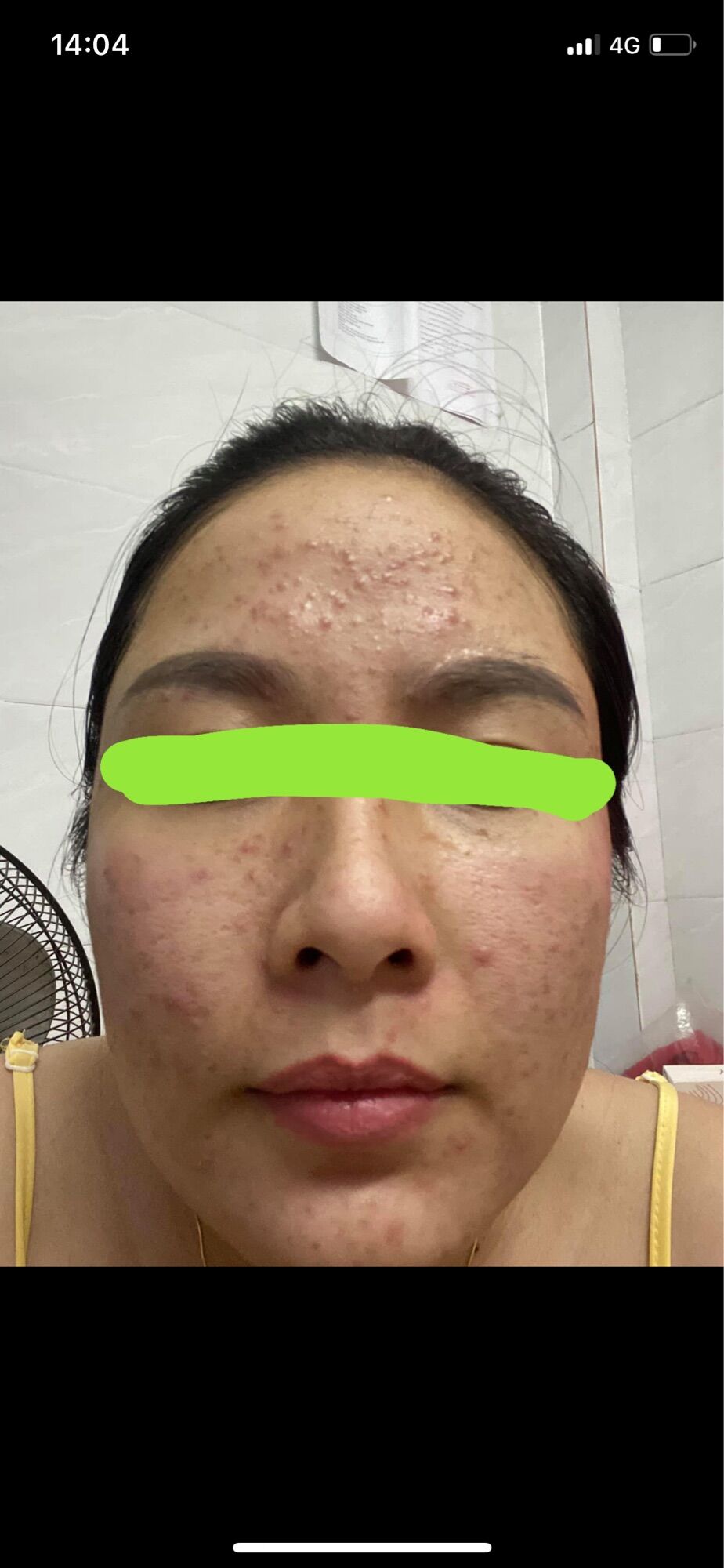 CỐT NHÂN SÂM TR.Ị M.ỤN,THÂ.M