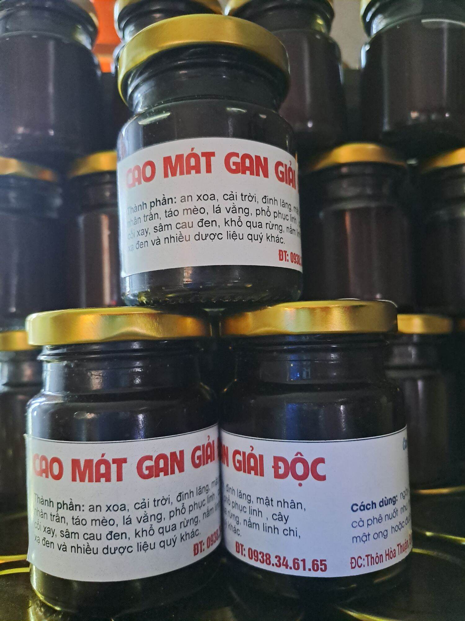 cao  sỏi thận , sỏi tiết niệu