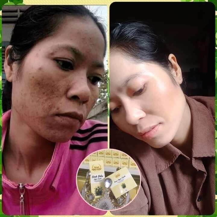 Bộ đôi Kem Face Ngọc Oanh