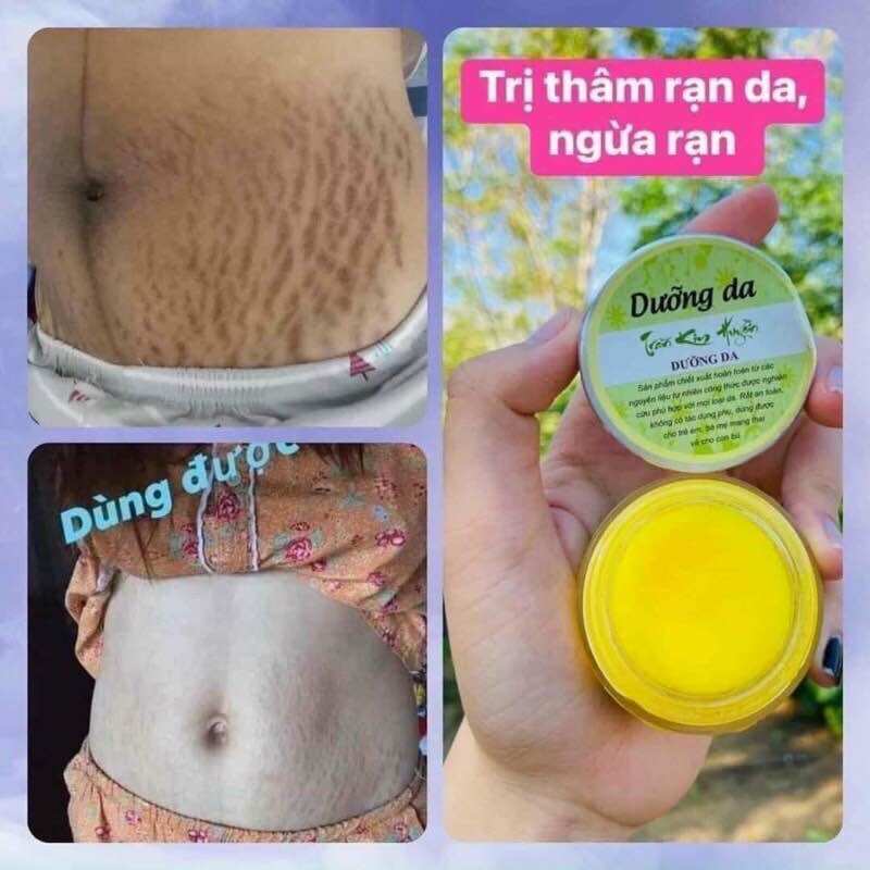 Kem Dưỡng Da Thảo Mộc TKH