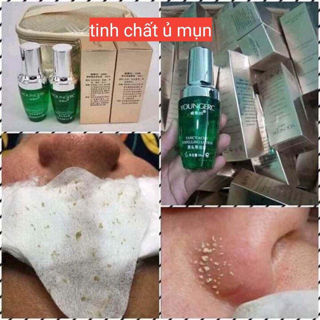 1 lọ ủ mụn younger chuyên dùng cho spa