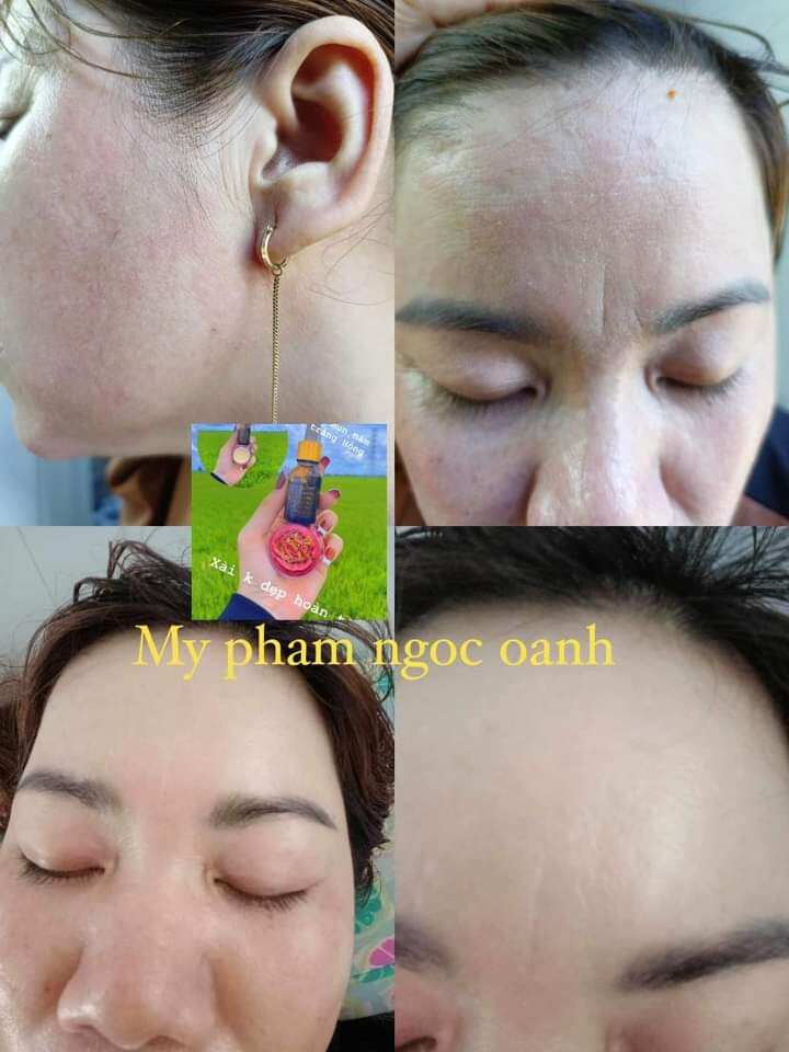 Bộ đôi Kem Face Ngọc Oanh