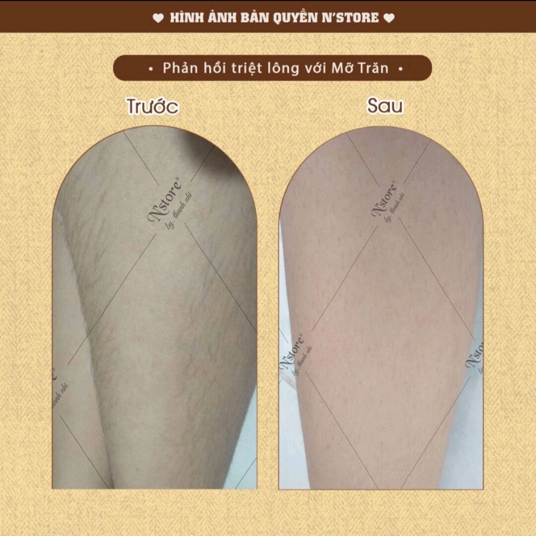 Mỡ trăn nguyên chất N'store, triệt lông, mờ rạn da
