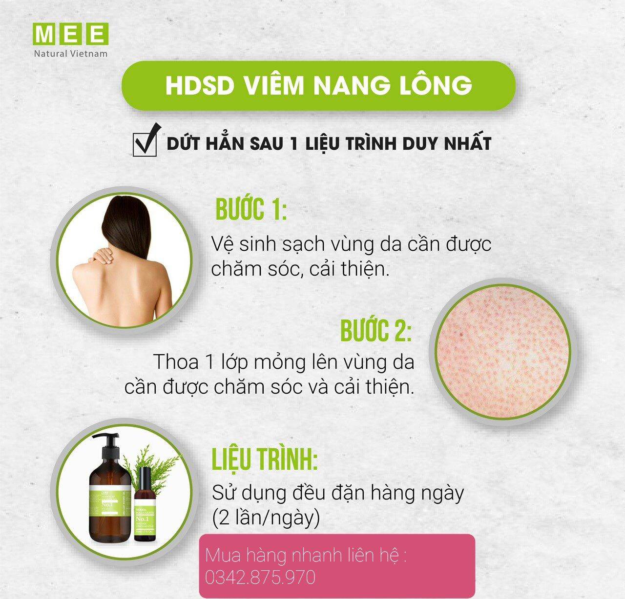 [ XỊT 100ML, SỮA TẮM ] COMBO MEE NATURAL CHO VNL