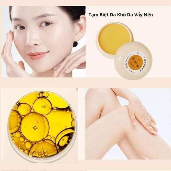 kem nứt gót chân heyxi chính hãng
