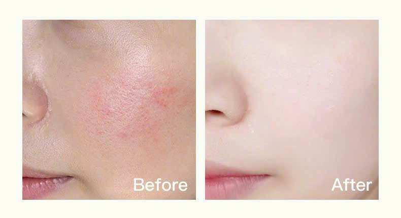 Tên sản phẩm: Máy đẩy tinh chất & Nâng cơ massage mặt