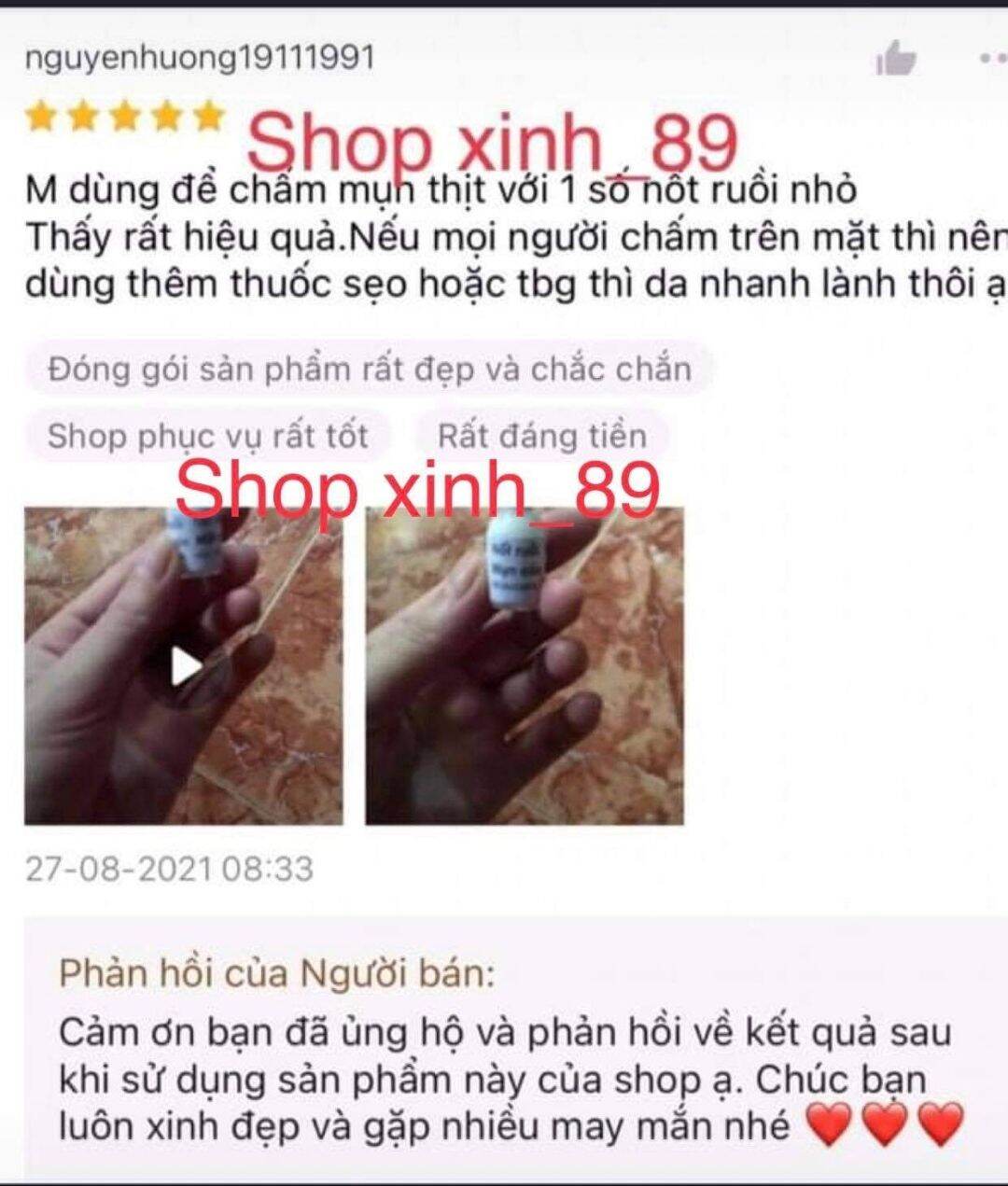 Kem tẩy nốt ruồi, mụn cóc, mụn thịt, mụn cơm, mắt cá handmade