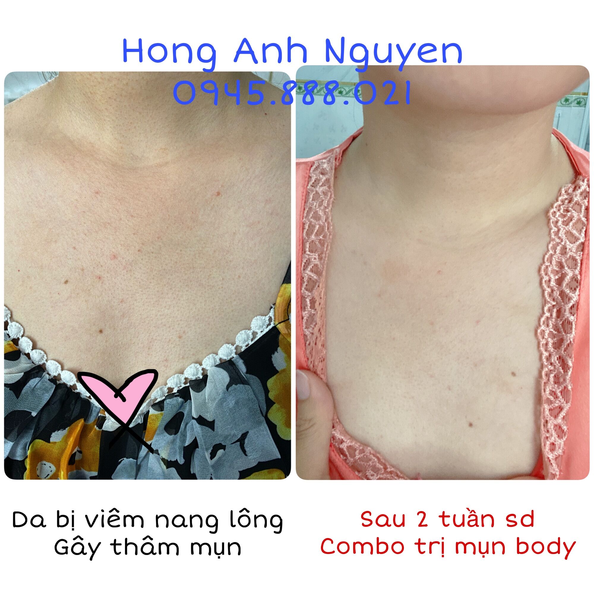 Kem dưỡng Paula Choice 2% BHA