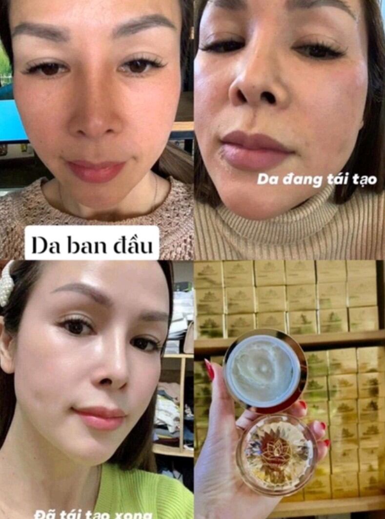 Kem tái tạo vàng Chamomile skill
