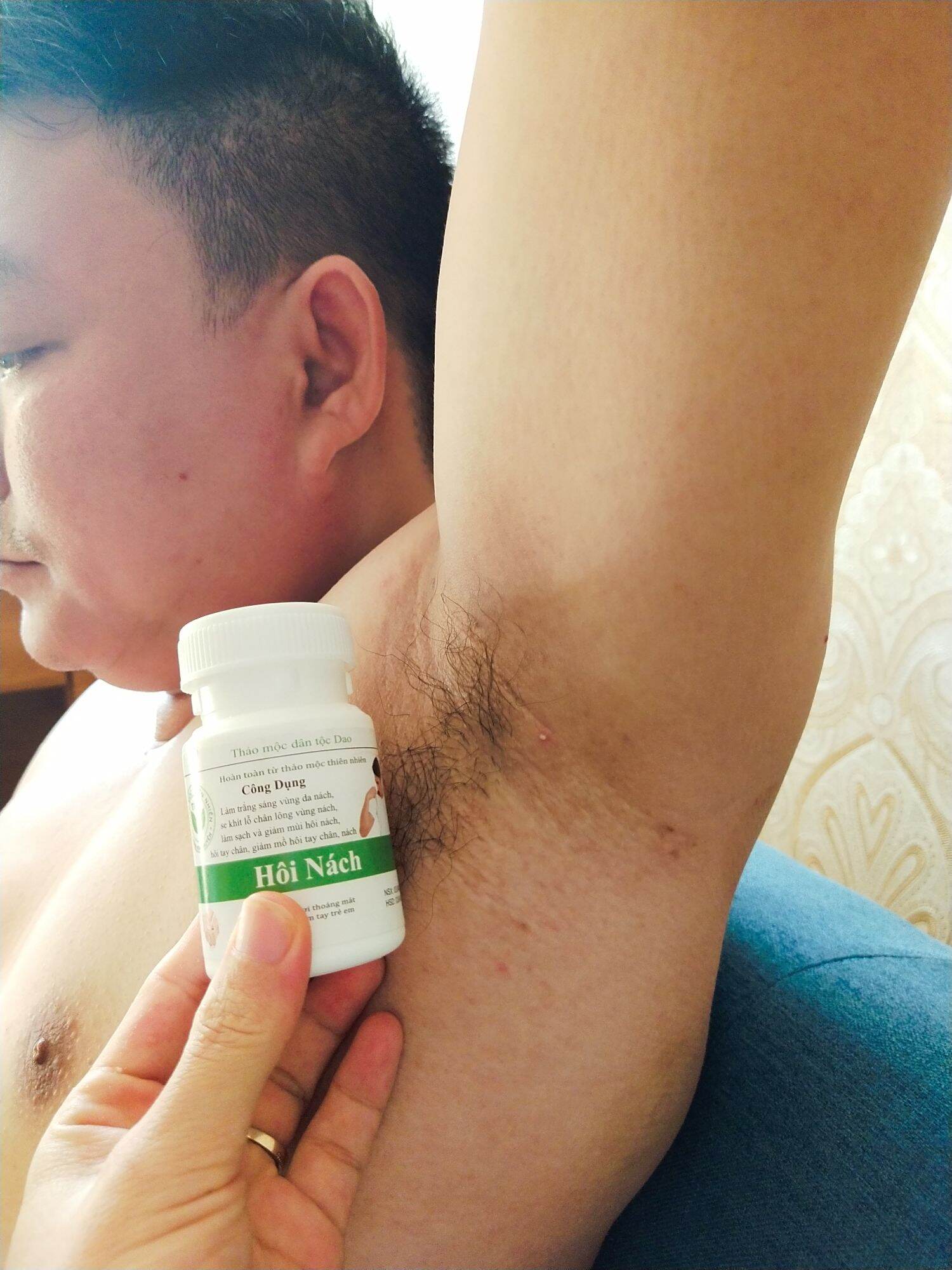 Hôi Nách Trần Kim Huyền