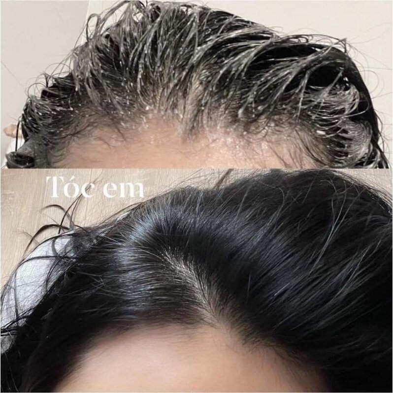 Tẩy tế bào chết tóc và da đầu JIORNIEE 250gr