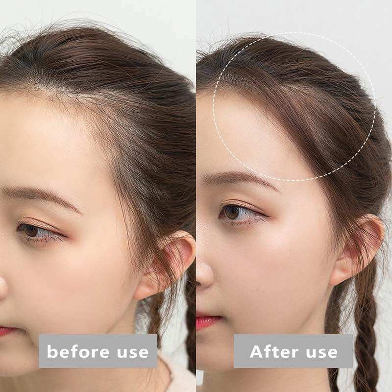 Suake Phấn Phủ chấm hói che khuyết điểm chân tóc đa năng