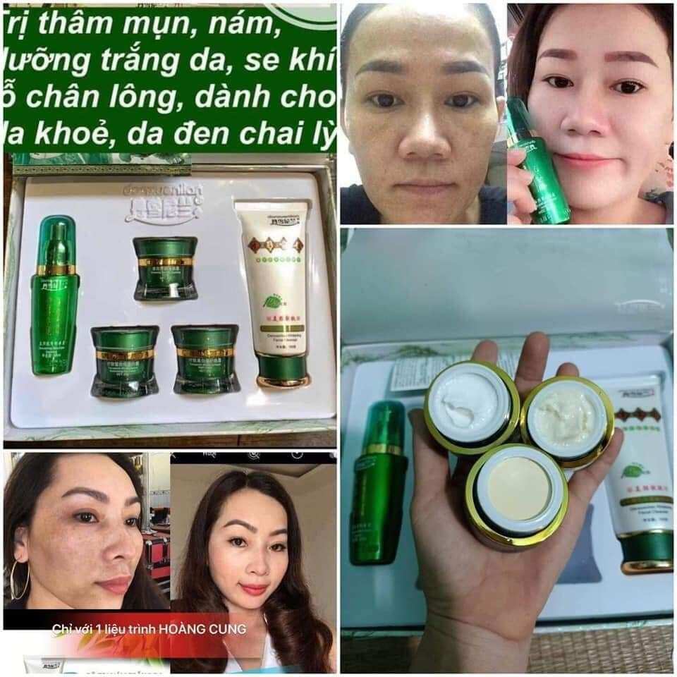 Bộ hoàng cung xanh 5 in 1 chính hãng