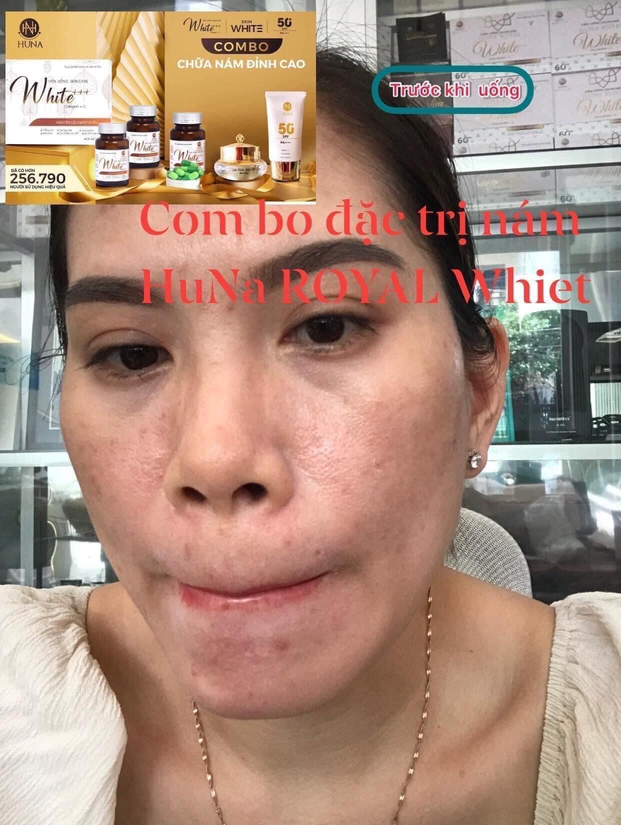 Viên Uống Trắng Da Mờ Nám White+++ Cao Cấp Huna