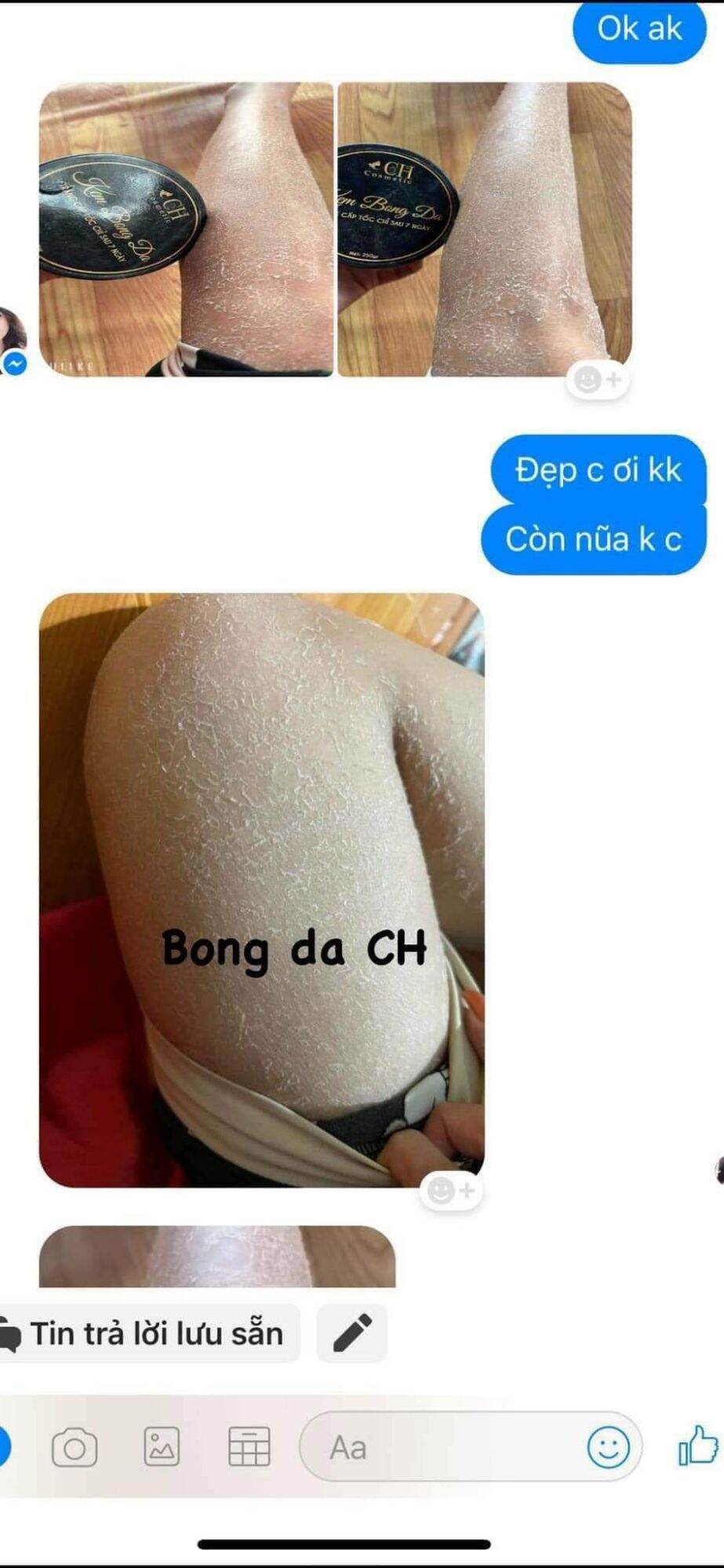Body Bong Da Trắng Sau 7 Ngày