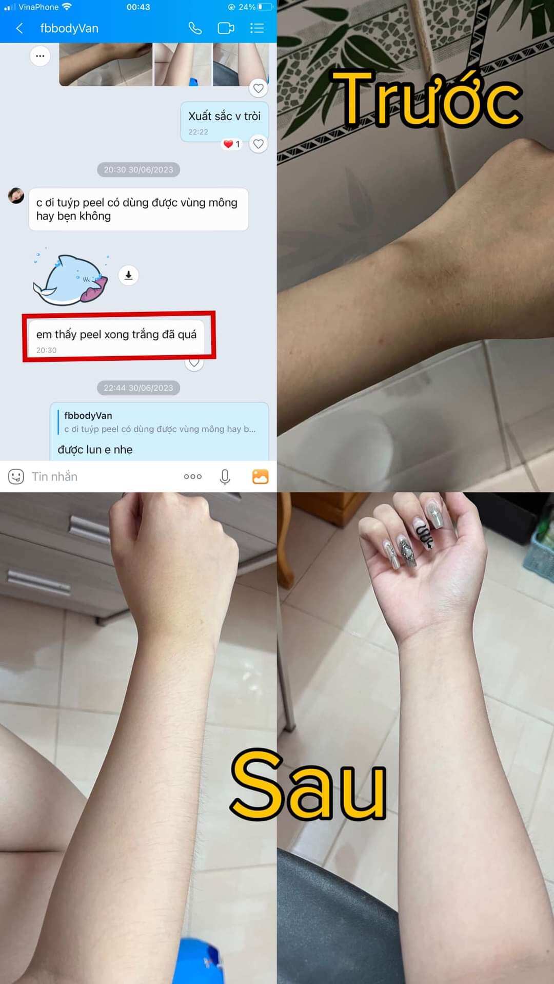 [mẫu mới]peel body,peel nách Le'peau