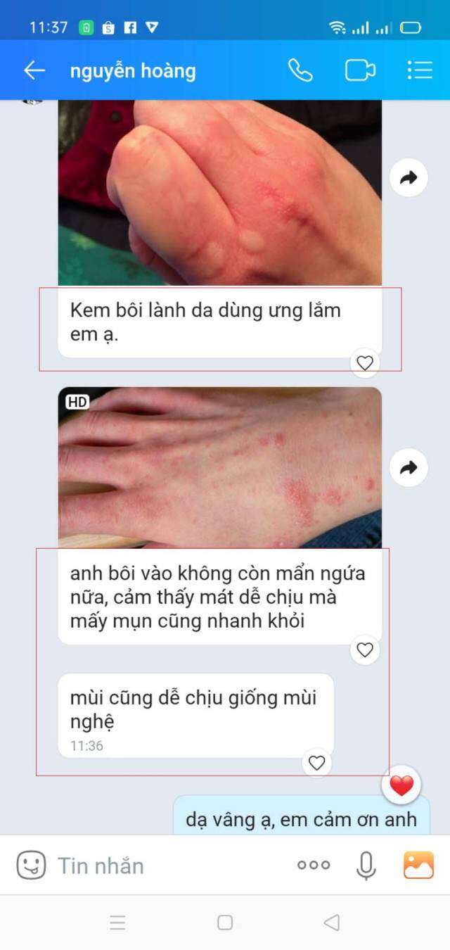 KEM BÔI DA BOLADA
