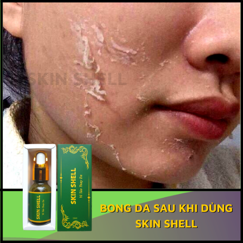 COMBO 5 VI TẢO BONG DA