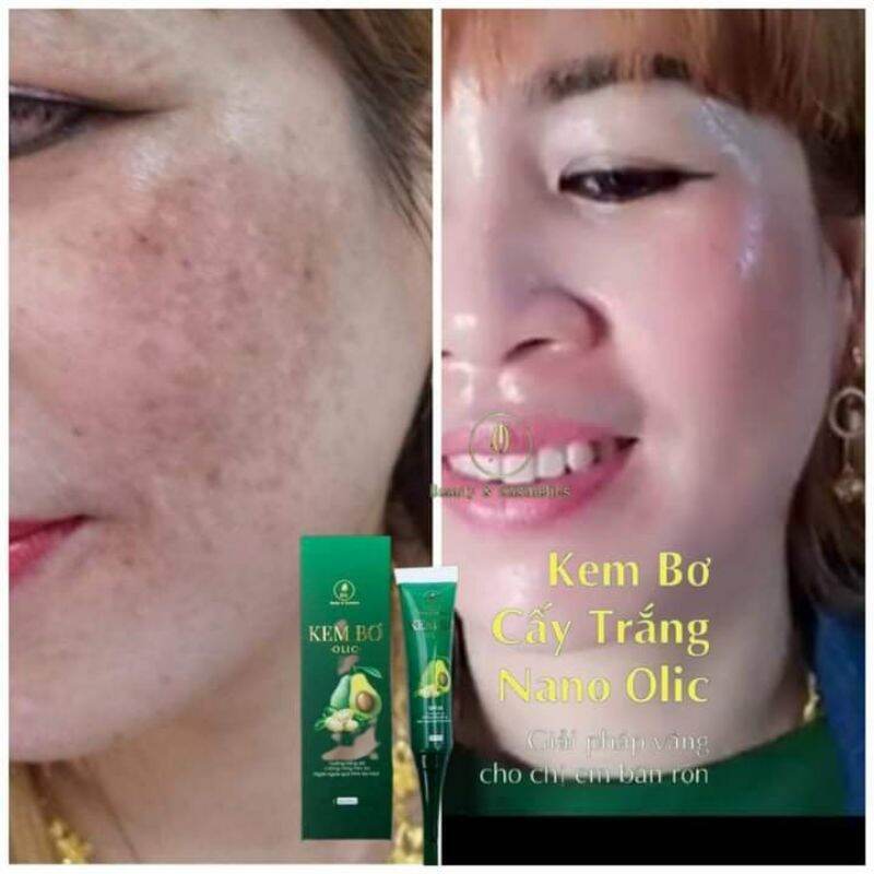 (Combo 5 kem bơ) Kem bơ olic