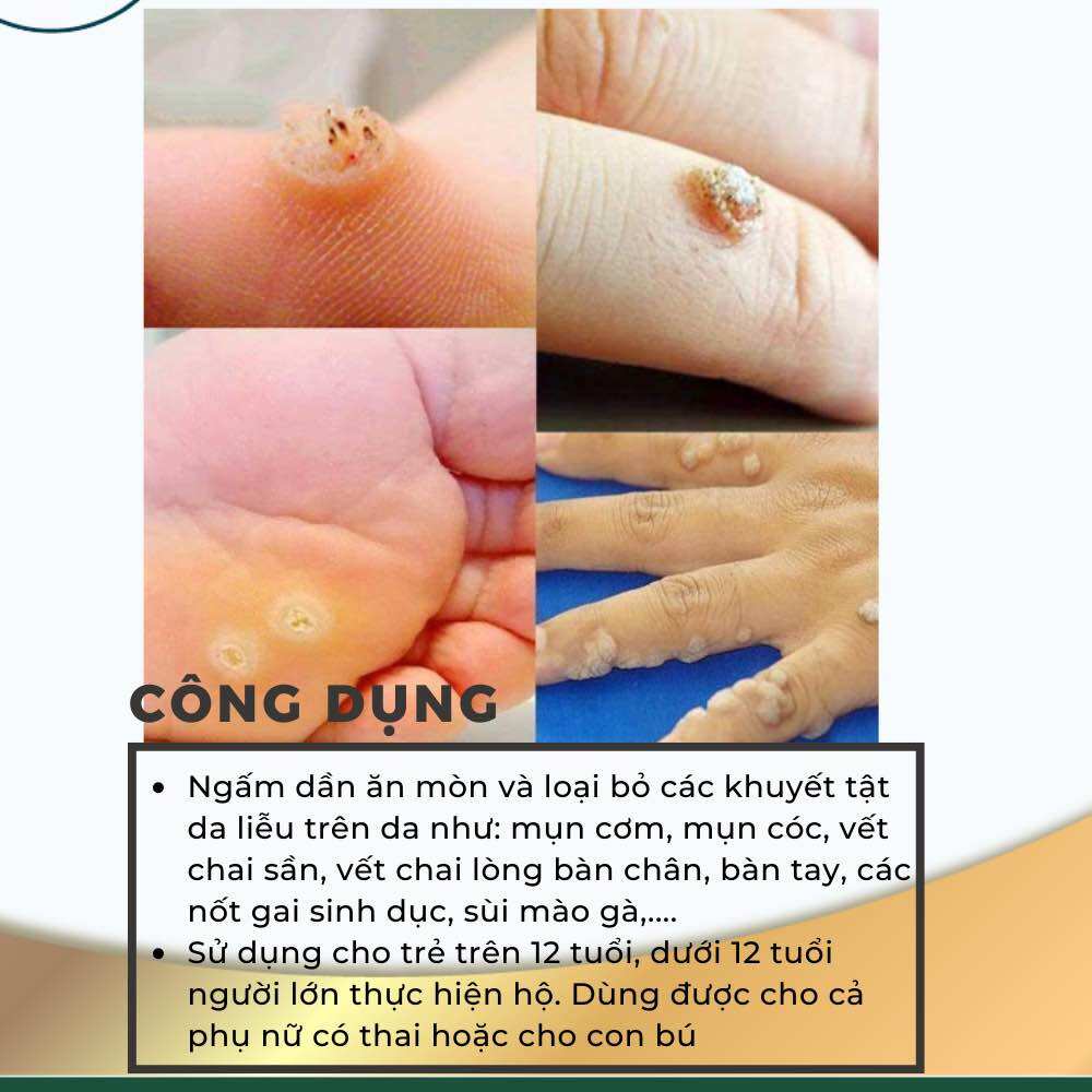 Mụn Cơm Mụn Cóc Mắt Cá Chân Vết Chai Sần