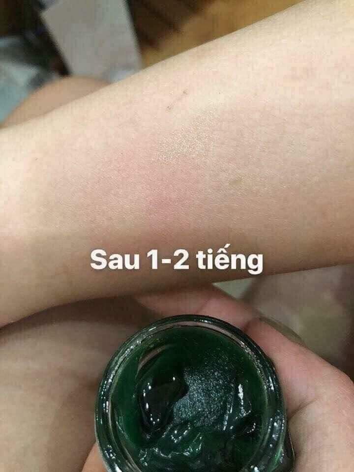 CAO BÔI MUỖI ĐỐT THÁI LAN