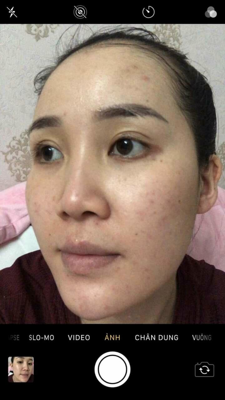 (1 chai)Tinh chất Tái tạo da hồng sâm MC_SKIN (chínhhãng).