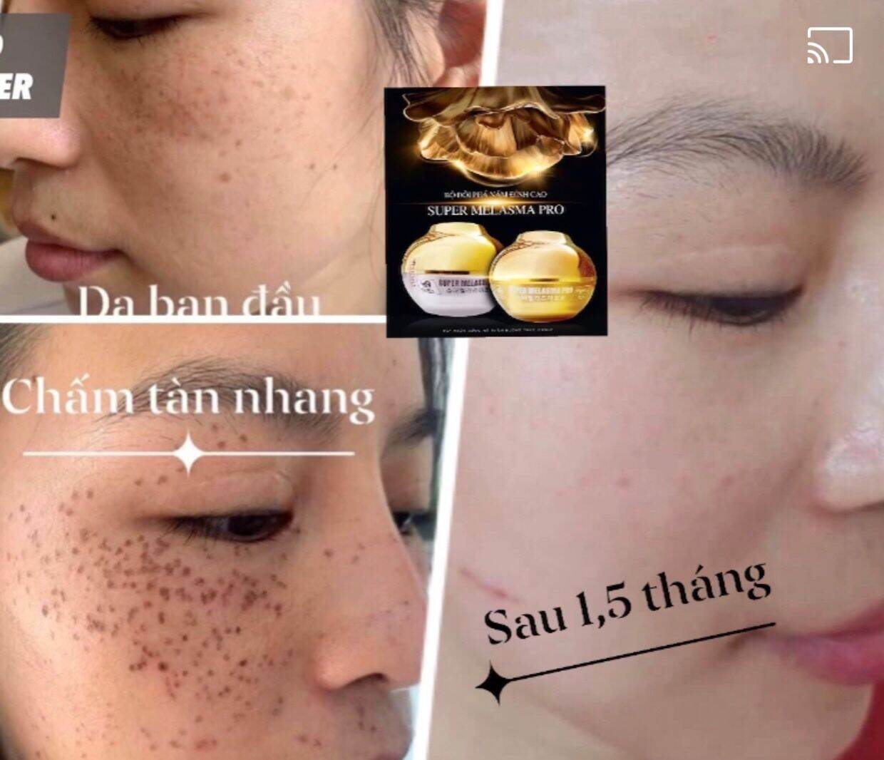 BỘ ĐÔI PHÁ NÁM