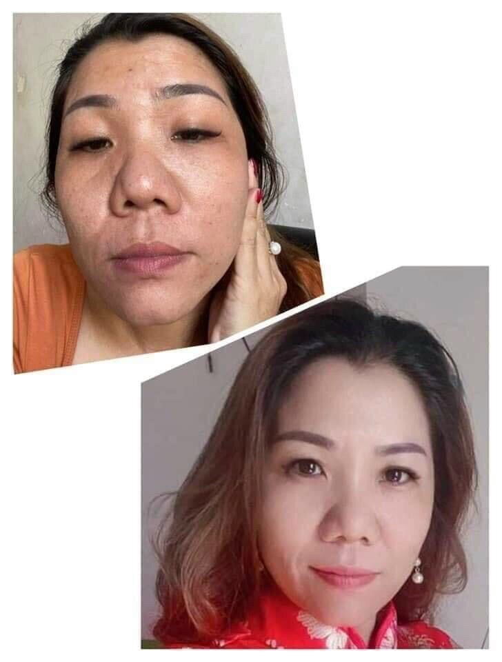 Serum siêu vitamin C