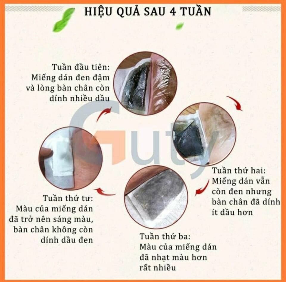 Miếng Dán Gan Bàn Chân Thải Độc Hộp 50 Miếng