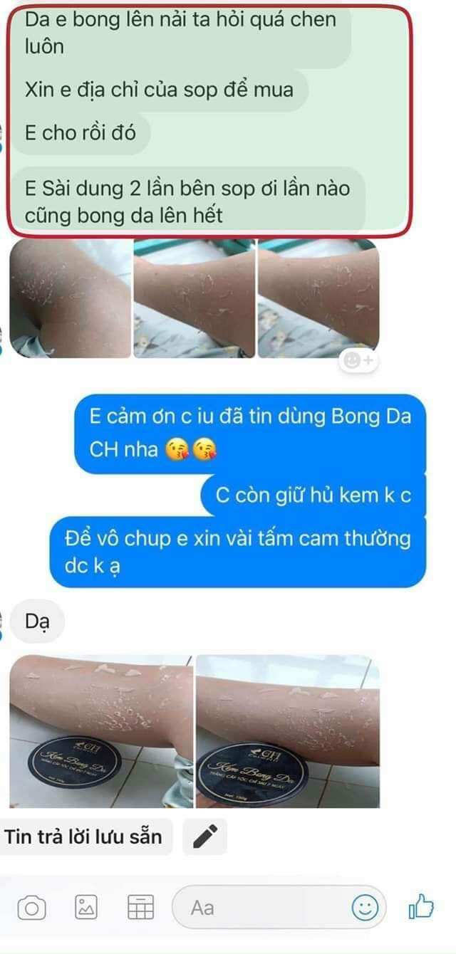 Body Bong Da Trắng Sau 7 Ngày