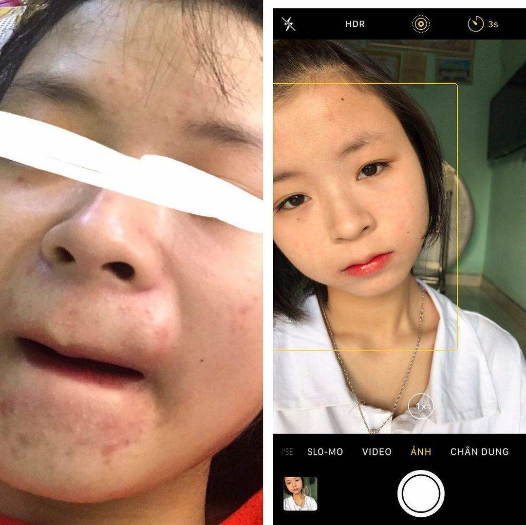 Đông y Sắc Ngọc Nữ tái tạo da