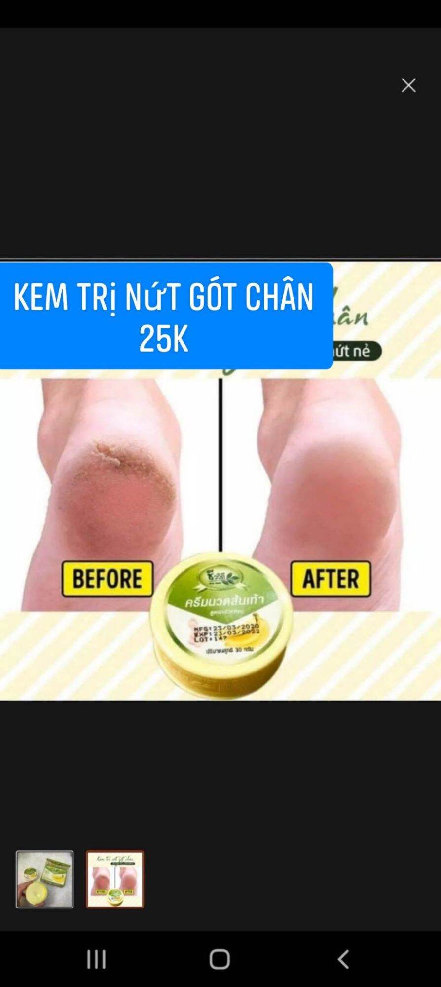 Kem bôi nứt gót chân