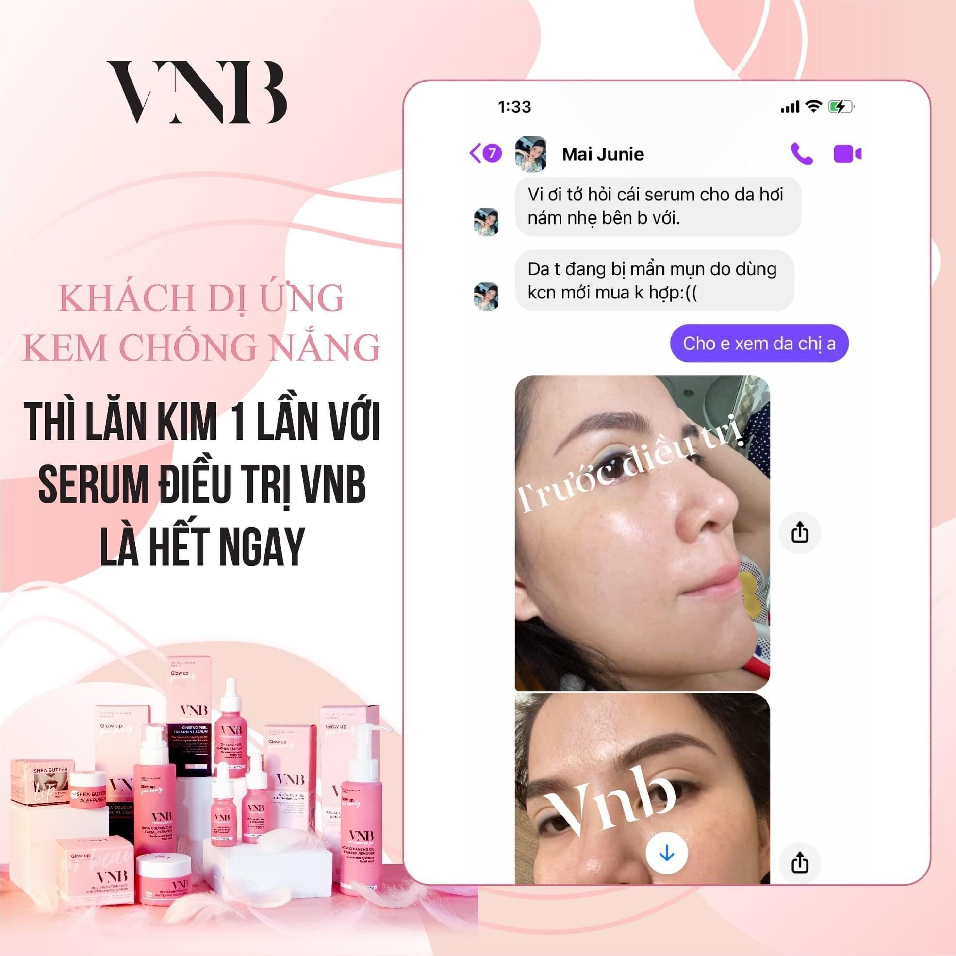 [Hcm]Chọn Bộ Serum Peel Nhẹ Vnb