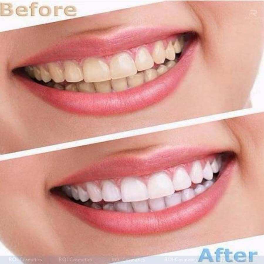 [COMBO 20 MIẾNG/10 NGÀY]MIẾNG dán trắng răng Crest 3D Professional Effects <FREE SHIP SHOP TÀI TRỢ> HÀNG MỸ LEVELS 18