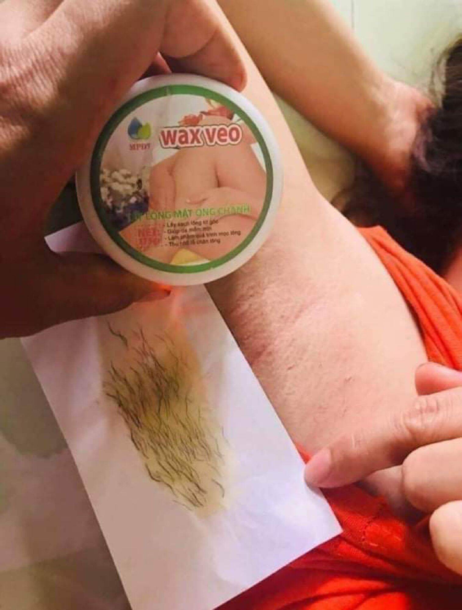 Wax lông veo triệt lông vĩnh viễn , sáp wax lông , wax lông nách, wax lông chân , wax lông veo , Triệt lông vĩnh viễn