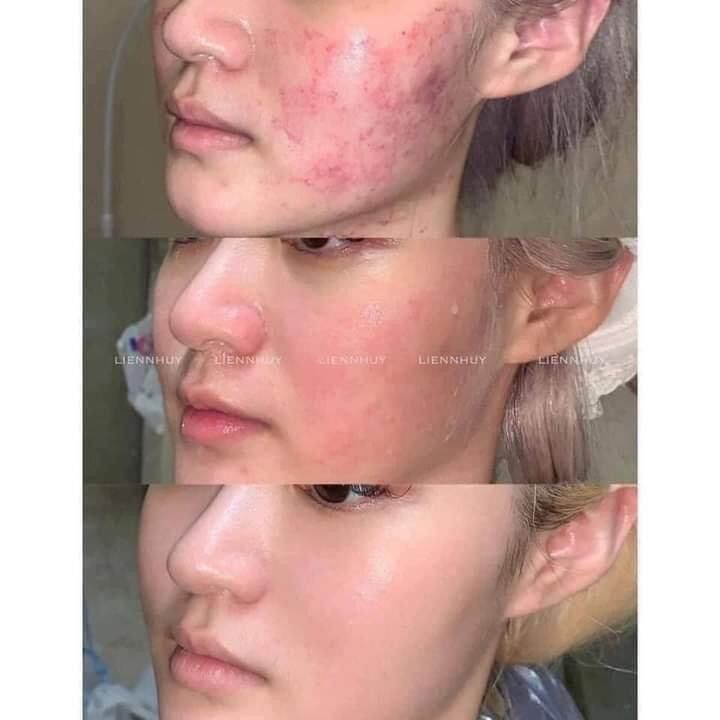 [Đủ Bill] kem dưỡng phục hồi Avene 100ml