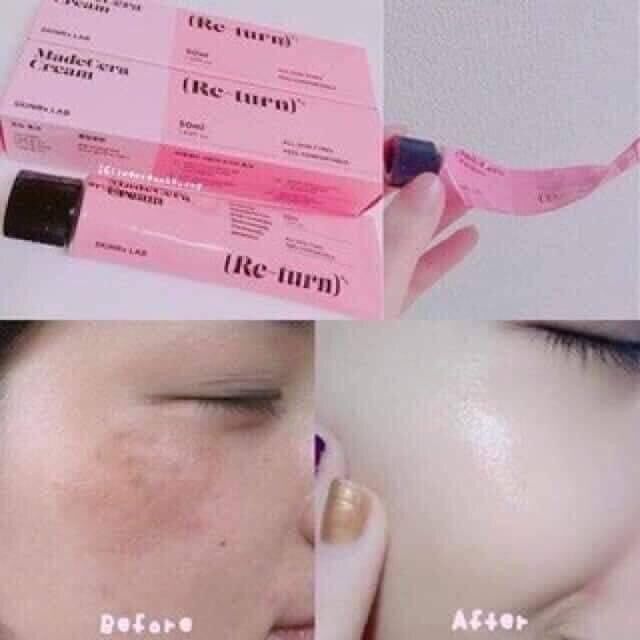Kem đánh bay sẹo thâm MadeCera Return thái lan tuýp 15gr
