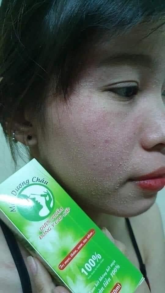 TÁi TẠO DA MỘC DƯƠNG CHÂU 30ML
