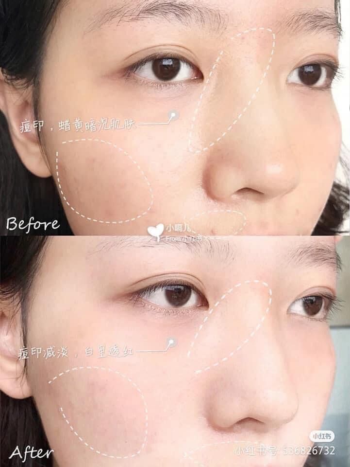Martiderm Pigzero DSP Bright dưỡng sáng đều màu